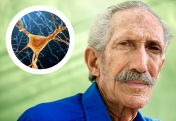 Learn more about New Angles on Alzheimer's Disease